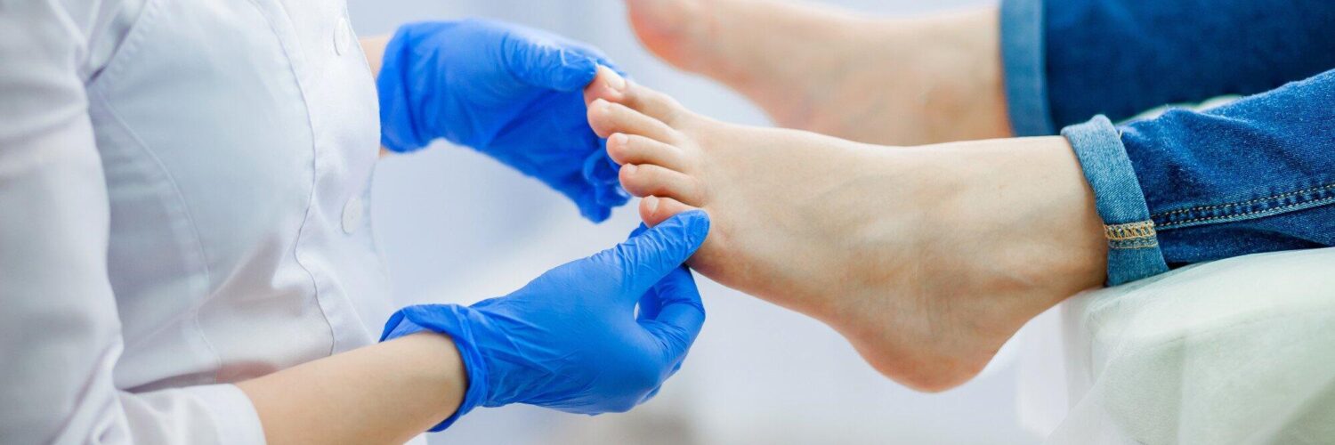 Why You Shouldn't Ignore a Toe Web Infection (What to Do About It)